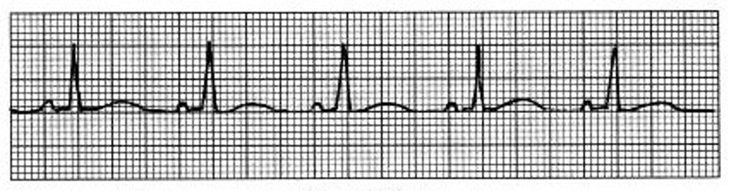 <p>rhythmic flow of a sequence</p>