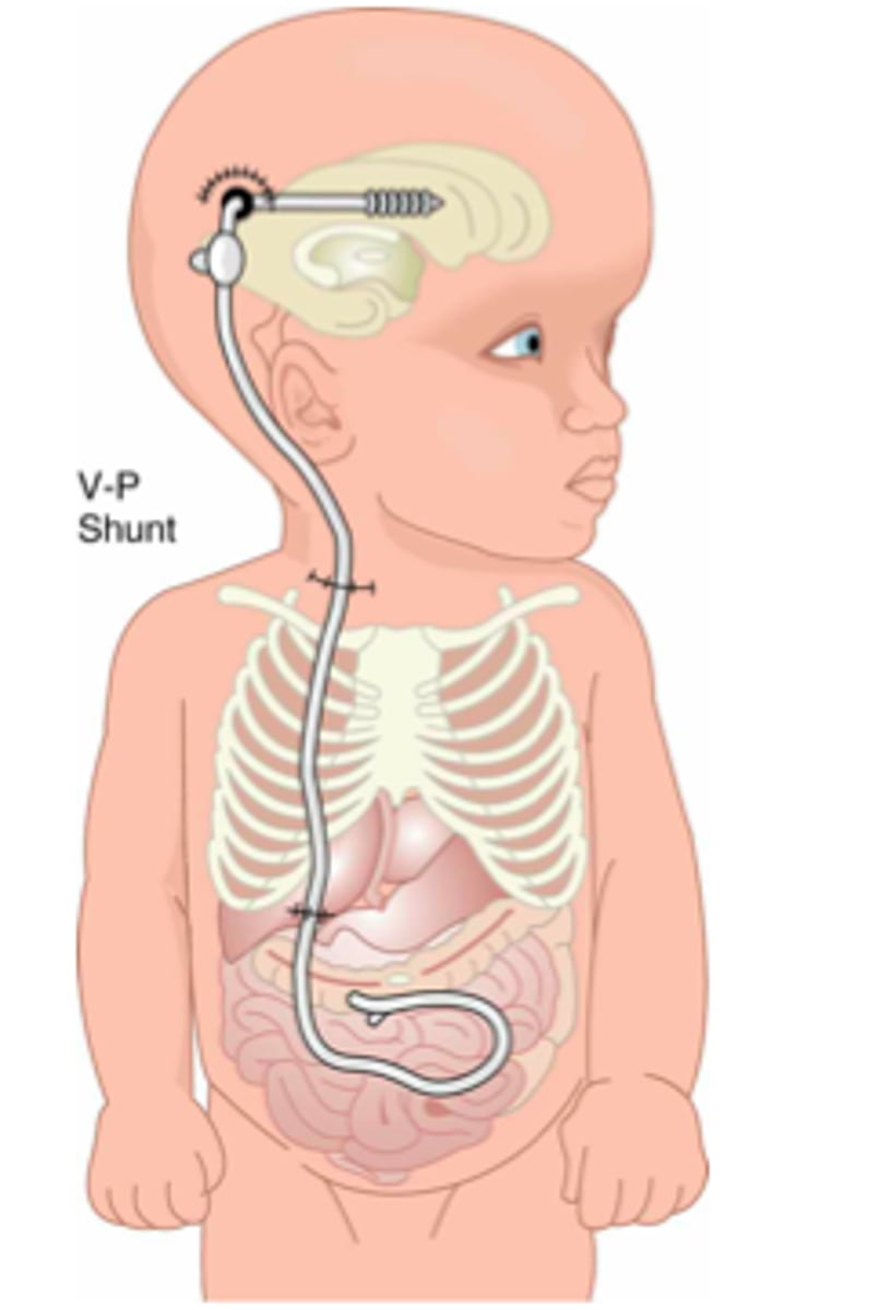 <p>v C2 to move aside </p><p>chuyển hướng </p><p>The train was ______ to another track.</p>
