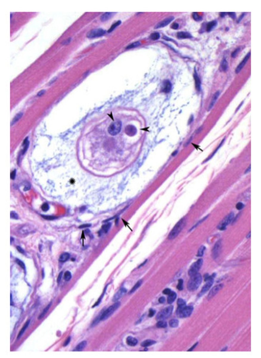 <p>ID the following parasite (dog)</p>