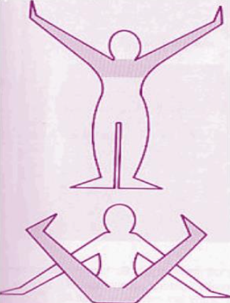 <p>What bilateral pattern is shown on the picture?</p>