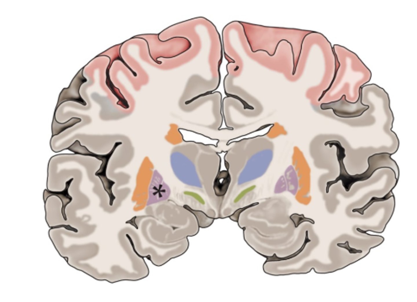<p>c. Globus pallidus</p>