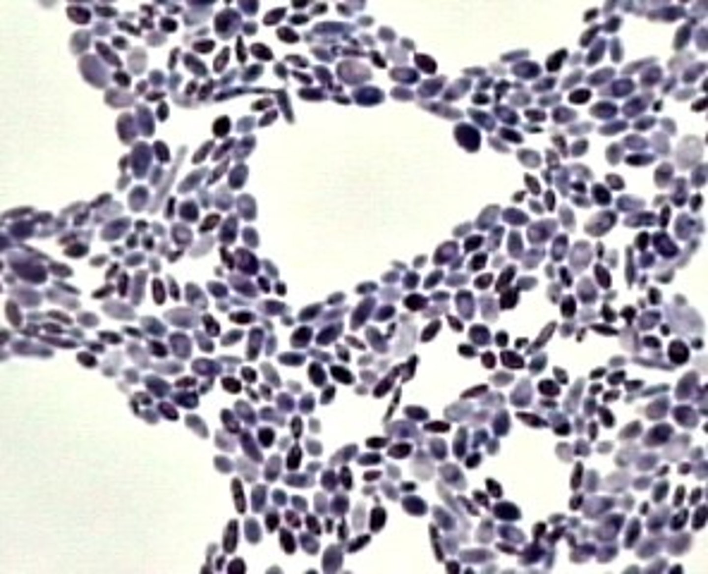 <p>Single-celled organism, fungal pathogen, eukaryotic.</p>