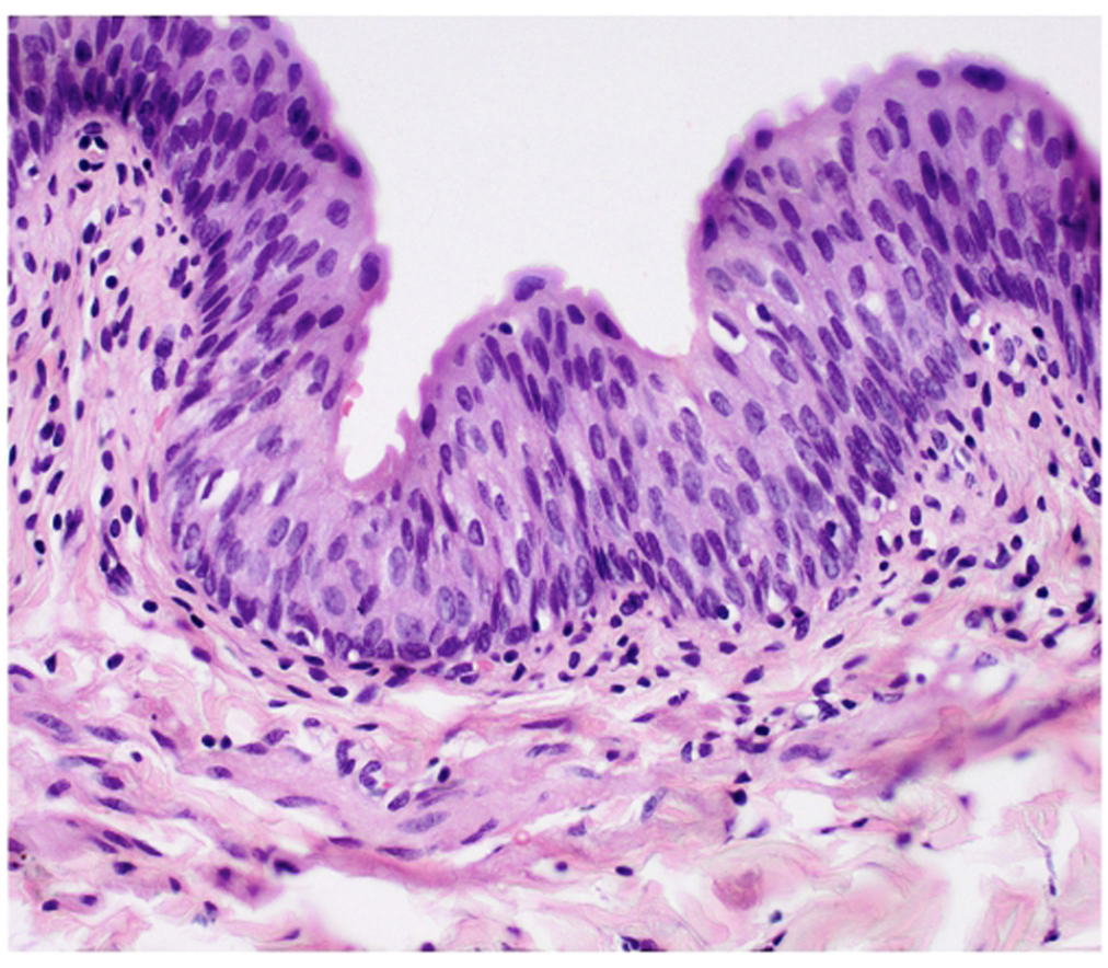 <p>Transitional epithelium.</p>