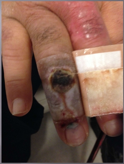 <p>What injury is this?</p>