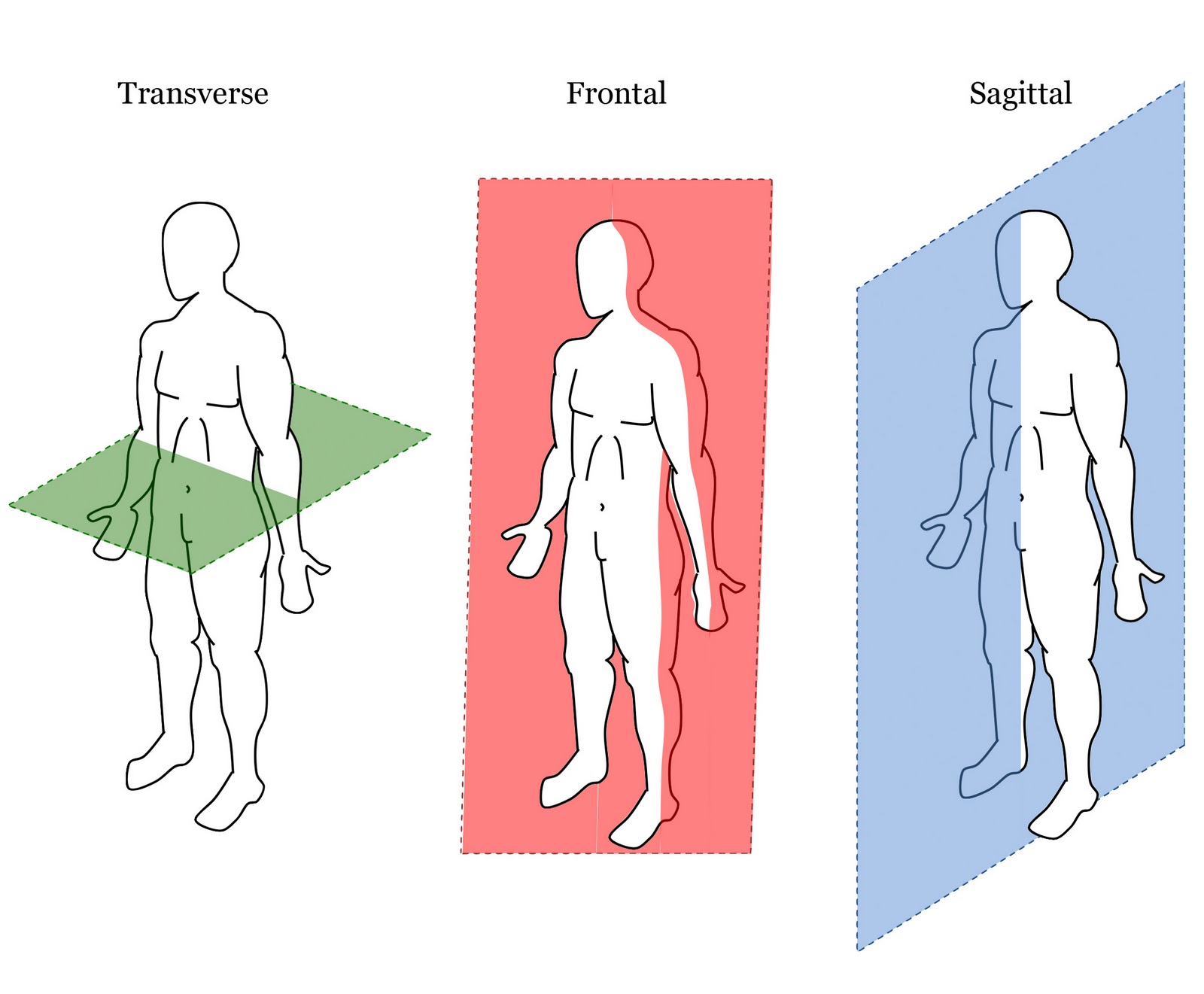 <p>aka coronal plane vertical plane divides body into anterior and posterior sections.</p>