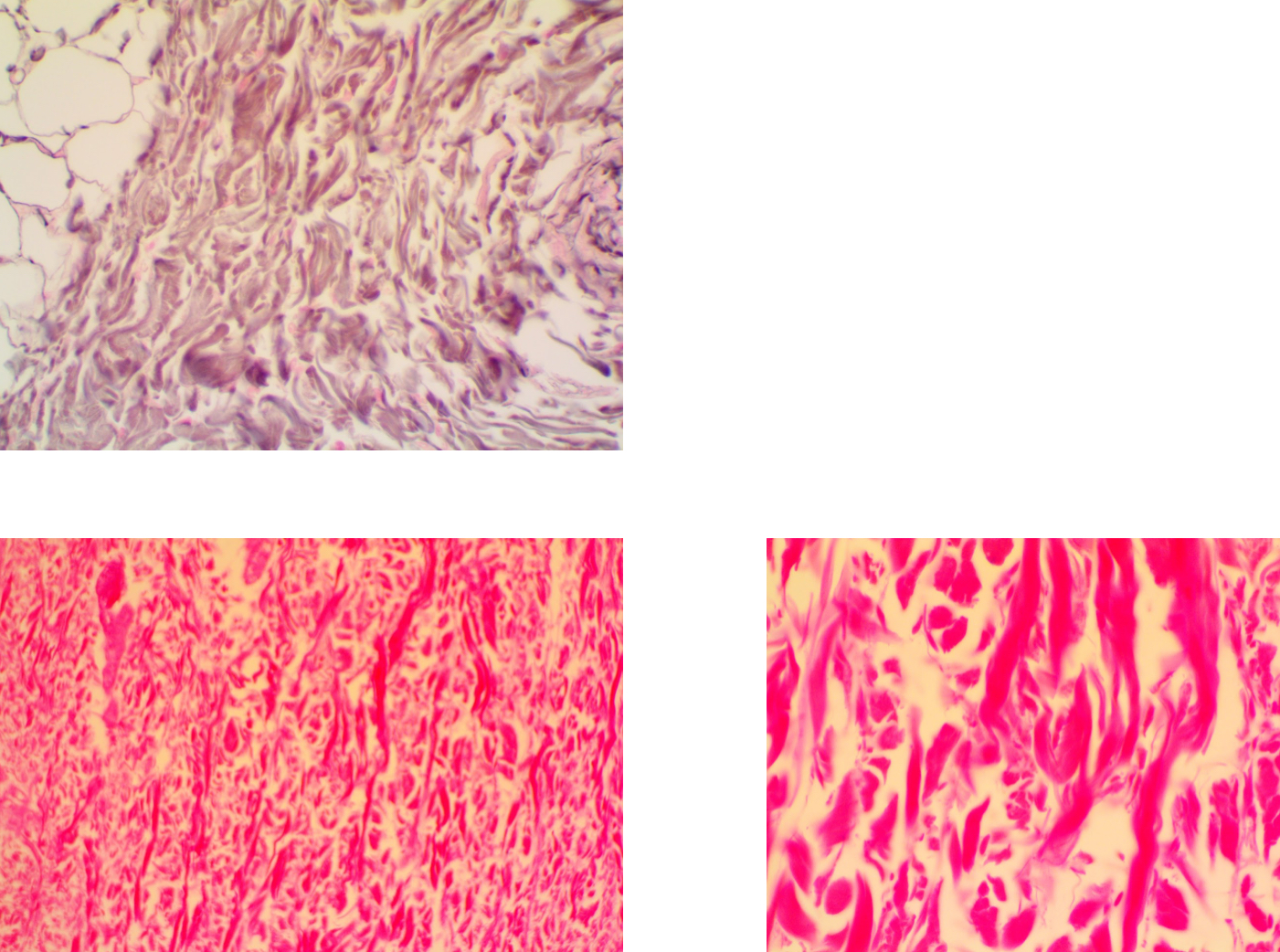 <p>Dense irregular fibrous tissue</p>