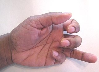 <p>Jersey Finger</p>