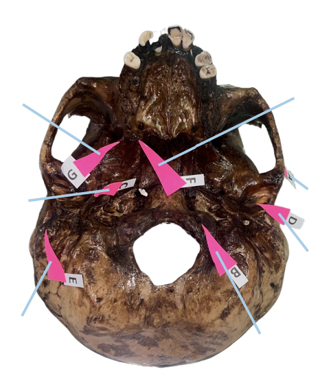 <p>What nerve passes through the “petrotympanic fissure” and what is the function of that nerve to the tongue?</p>