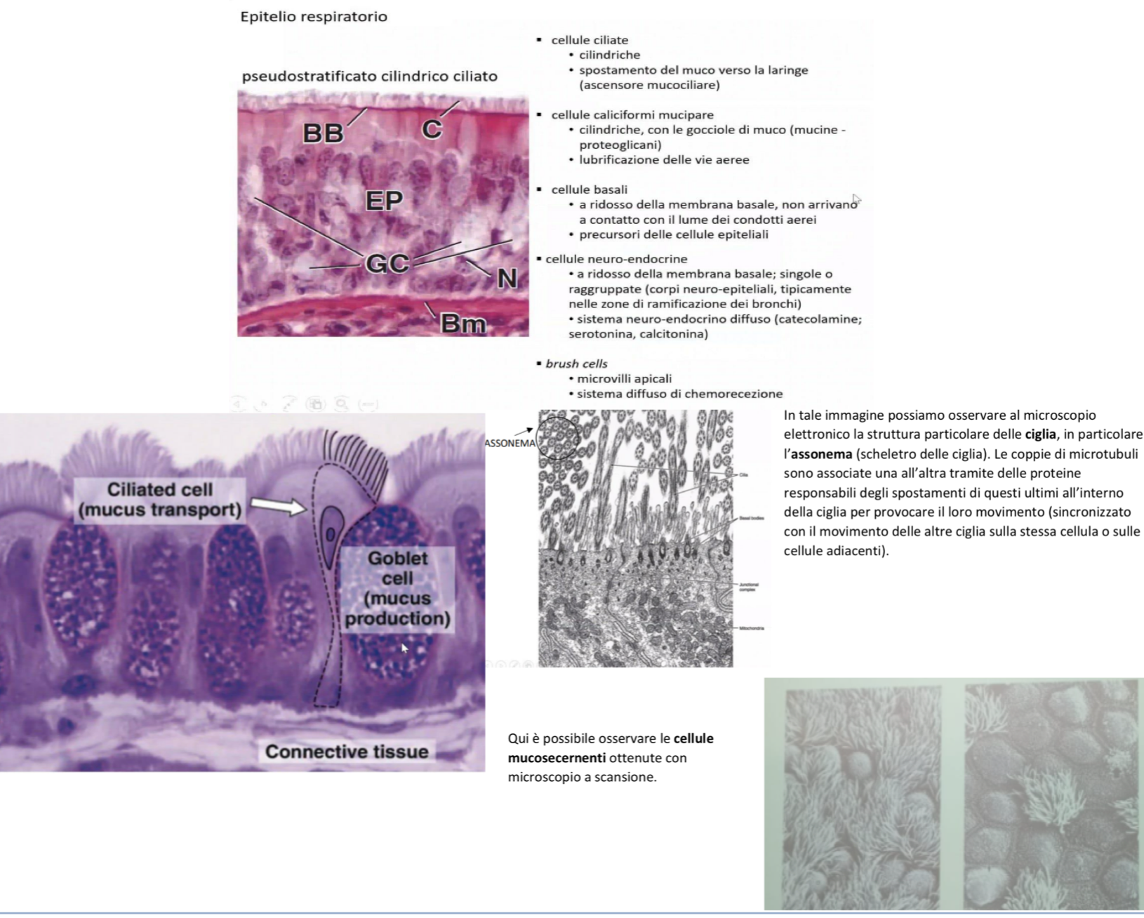 <p>L’epitelio respiratorio è un epitelio pseudostratificato cilindrico ciliato tipico delle vie aeree</p><p>Citotipi principali:</p><ul><li><p>Cellule ciliate cilindriche → un singolo strato dalla membrana al lume che presentano ciglia motili in superficie per spostare il muco </p></li><li><p>Cellule caliciformi mucipare → sono quelle che producono il muco che intrappolare microrganismi e particelle estranee</p></li><li><p>Cellule basali → strato basale aderente alla membrana basale che non raggiungono il lume e fungono da cellule staminali/precursori</p></li><li><p>Cellule neuroendocrine → tipo specializzato, meno numeroso, vicino alla membrana basale, secernono catecolamine, serotonina e calcitonina rispondendo alle variazioni di O2 e CO2 per modulare l’attività delle vie aeree</p></li><li><p>Brush cells (cellule a spazzola) → poco numerose, presentano microvilli in superificie, più lunghi ma non mobili. Aumentano la superficie per l’inserimento di recettori, per trasmettere segnali alle fibre nervose</p></li></ul><p></p>