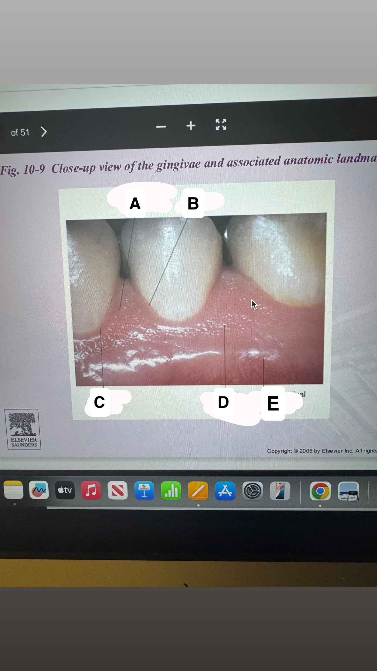 <p>Identify B </p>