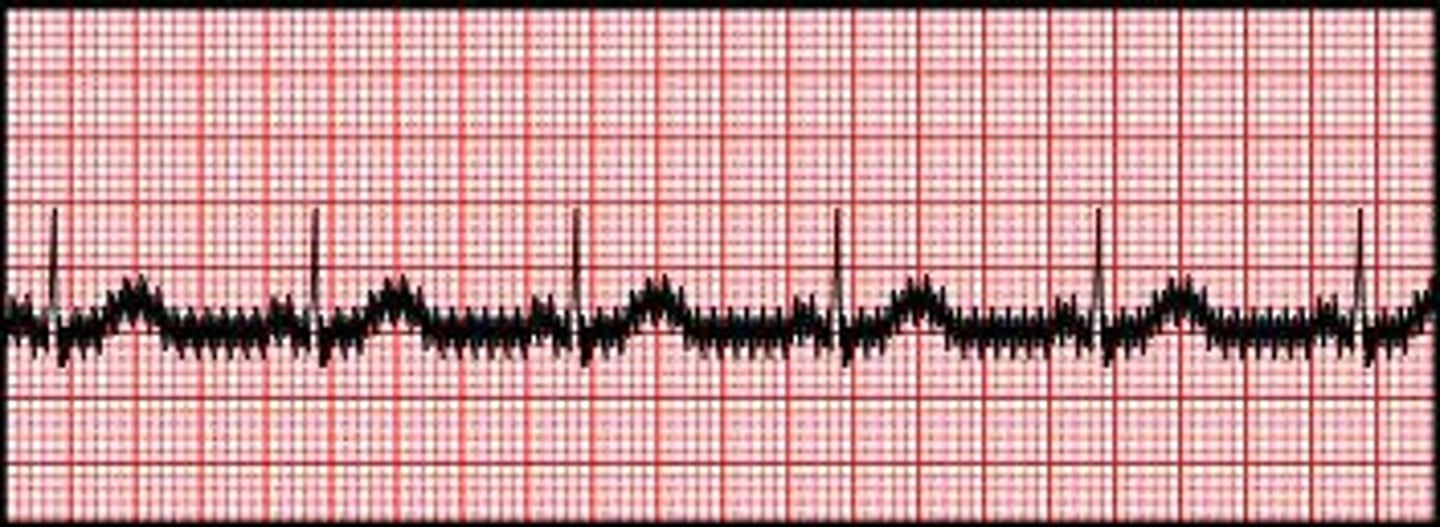 <p>AC interference</p>