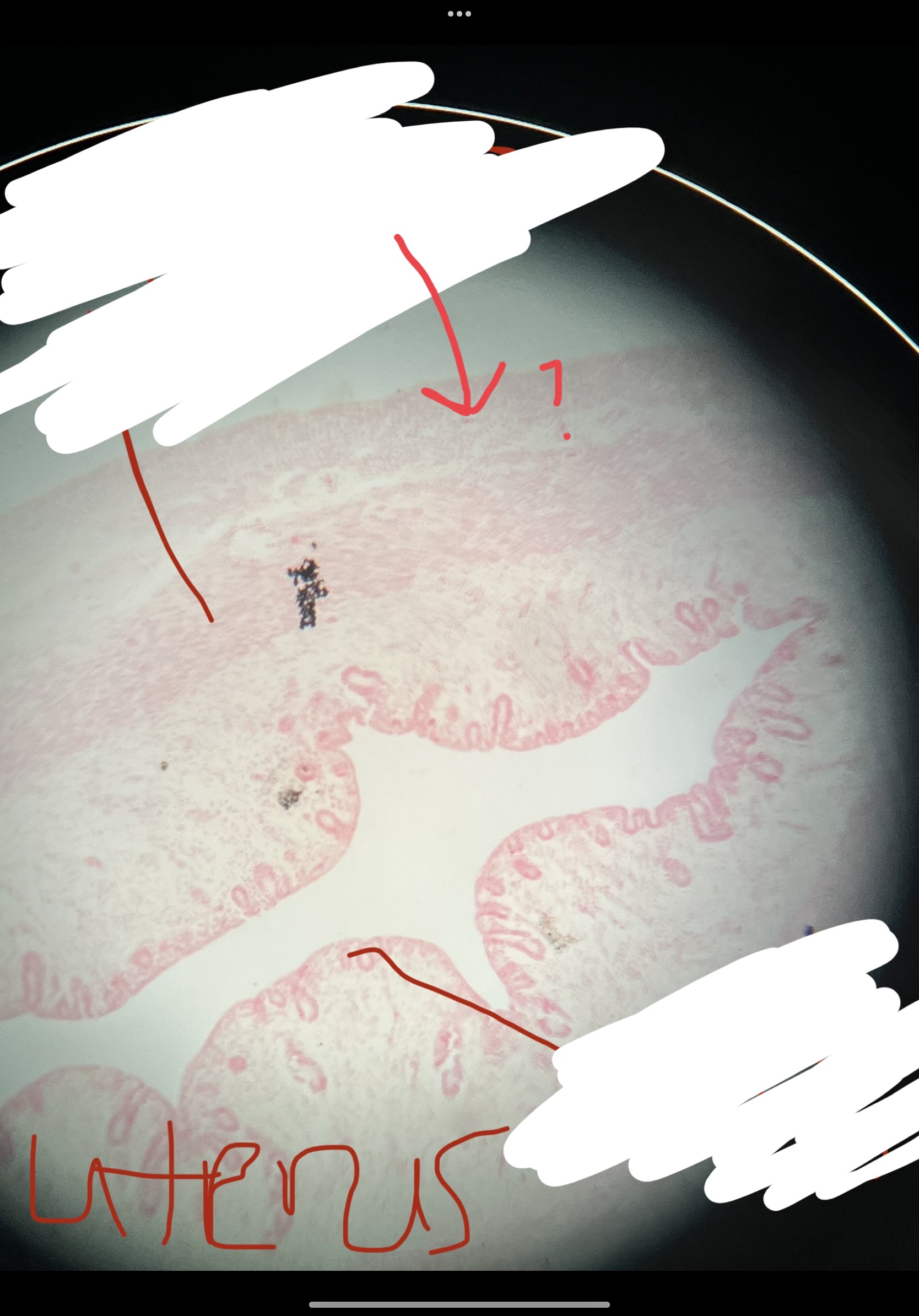What is the arrow pointing to?