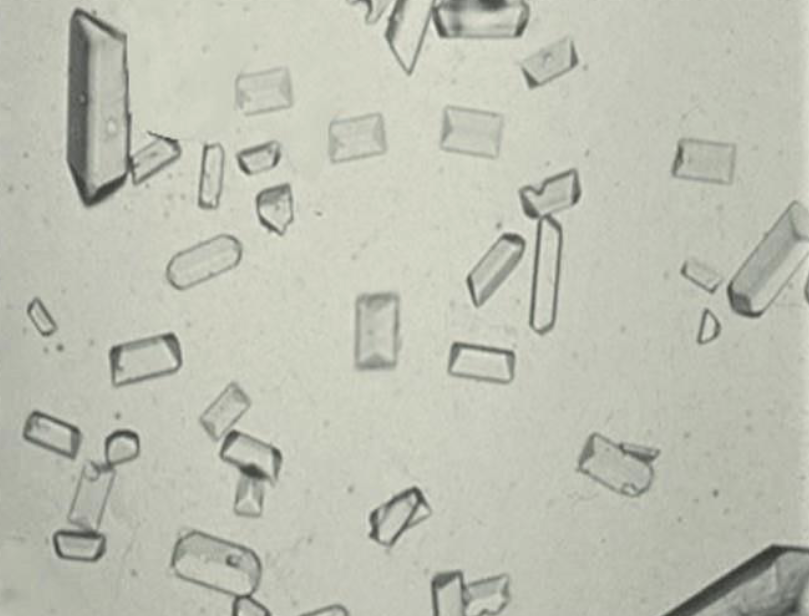 <p>What are these crystals?</p><p>What is their habitat? </p><p>What is the full name of the disease that these crystals are associated with?</p><p>What pH do these crystals like?</p><p>What are the three different names for this crystal?</p>