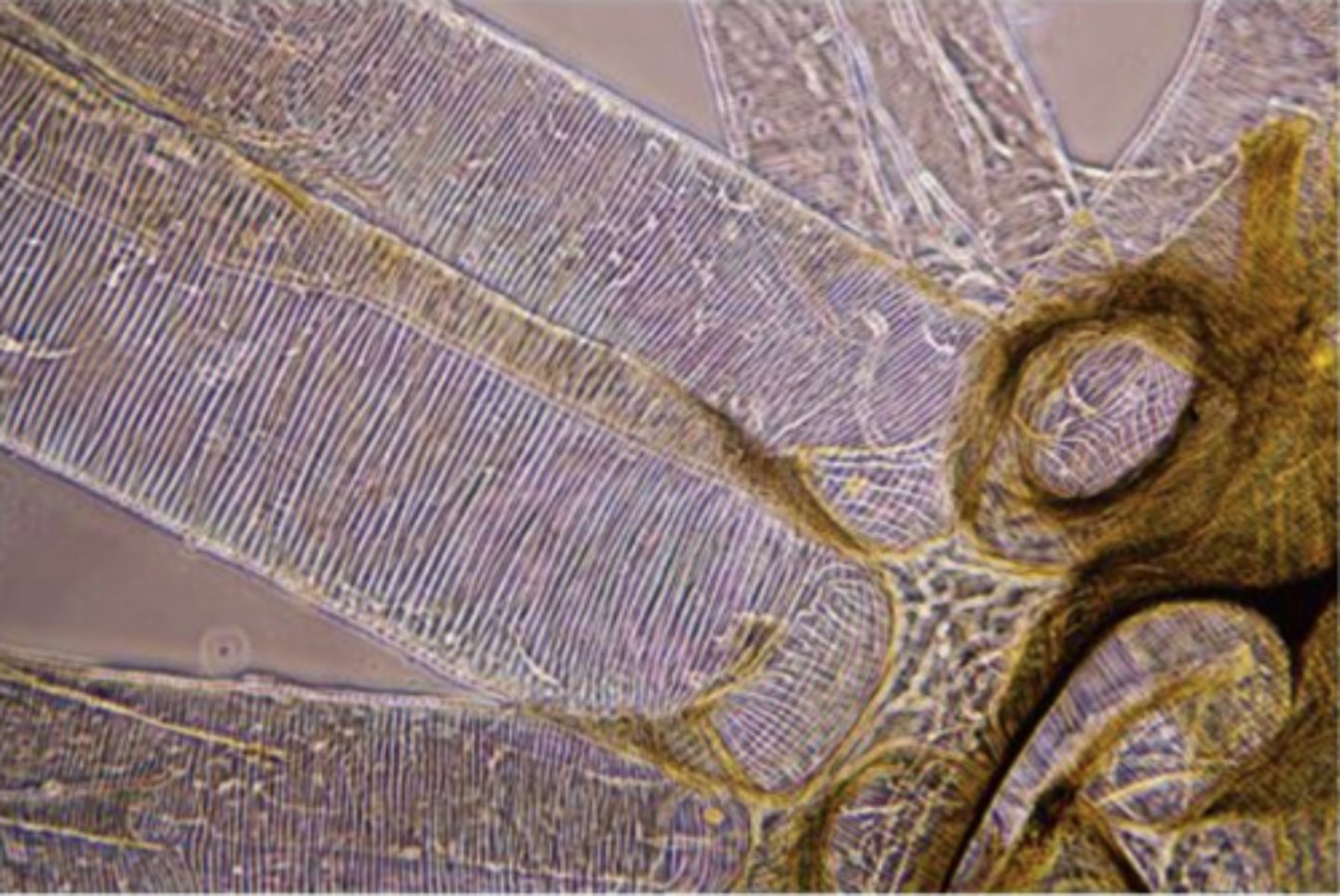 <p>walls of chitin,spiraclesandtrachae</p>