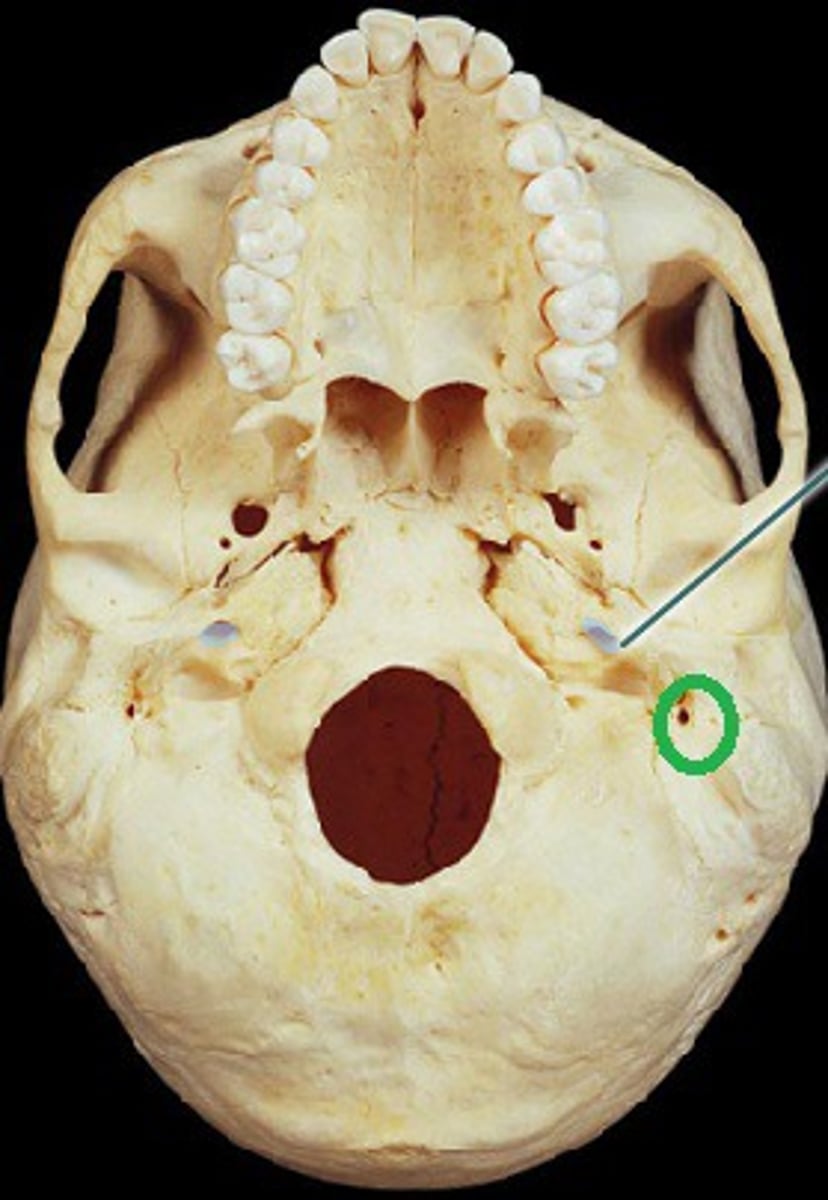 <p>what is this structure and what goes through it?</p>