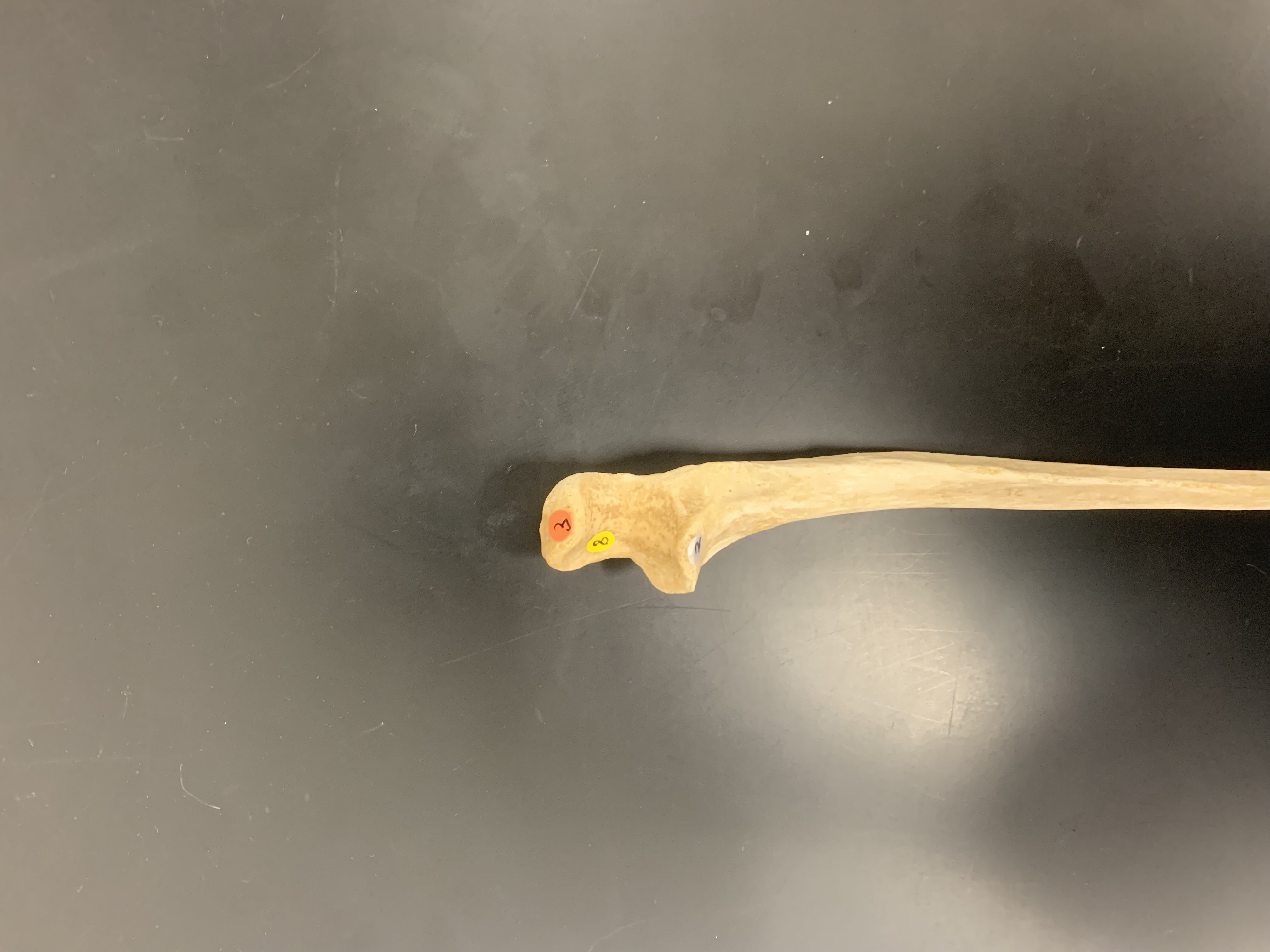 <p>Olecranon Process of Ulna</p>