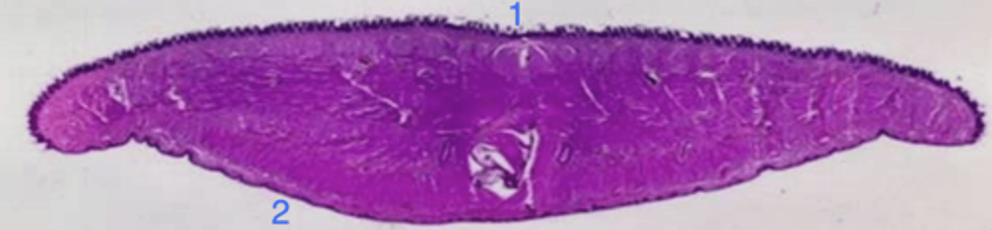 <p>how can you distinguish between the ventral and dorsal surfaces of the tongue? which is which in this picture?</p>