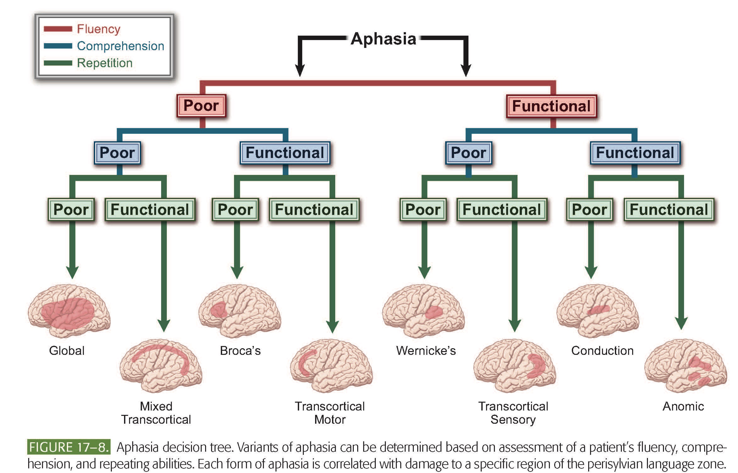 <p>Aphasia classifications</p>