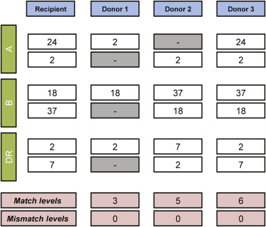 <p>Best fit: mismatch 0-0-0</p><p>Worst fit: mismatch 2-2-2</p><ul><li><p>hope to match each allele to the recipient (6 alleles in total: 2 loci, 2 alleles from parents)</p></li></ul><p></p>