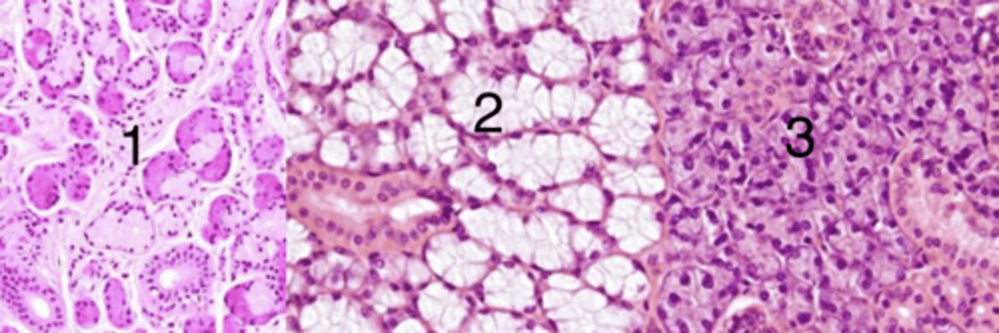 <p>which is a sample of the parotid gland? why?</p>