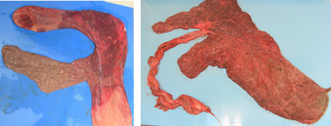 <p>What placental membranes are exposed in these pictures?</p>