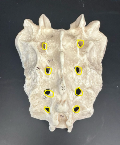 <p>What is circled in yellow?</p>