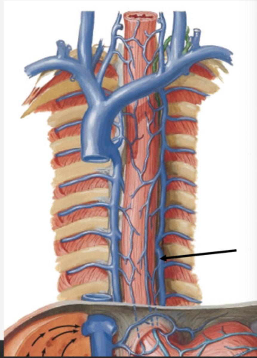 <p>Identify</p>