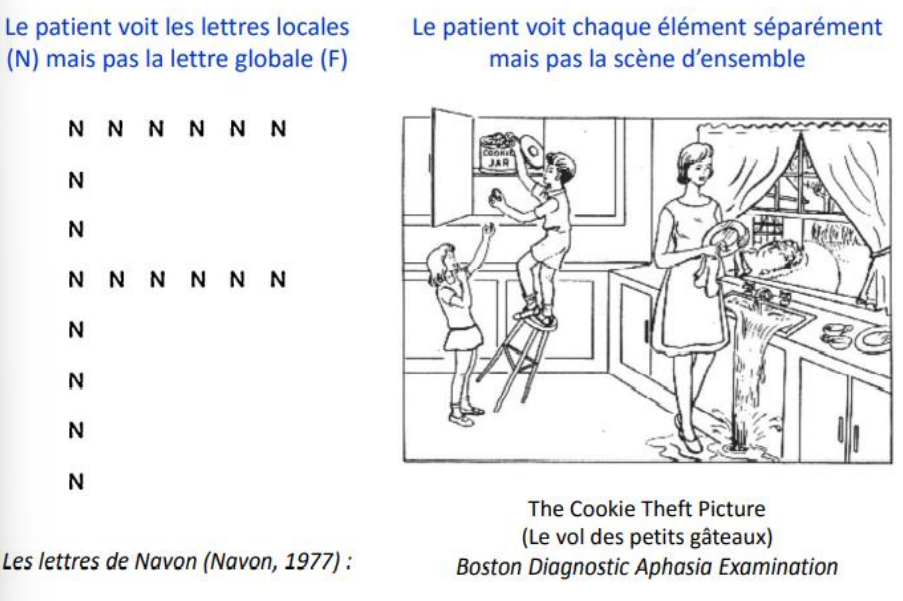 ncapacité visuo-perceptive pour interpréter une scène dans sa globalité alors que la capacité pour identifier chaque élément est préservée. Le patient ne perçoit qu’un objet à la fois, indépendamment de sa taille et de sa position dans le champ visuel.
→ Epreuve de description : la description que le patient fait de son environnement (chambre, salle de consultation,…), lettres de Navon,…