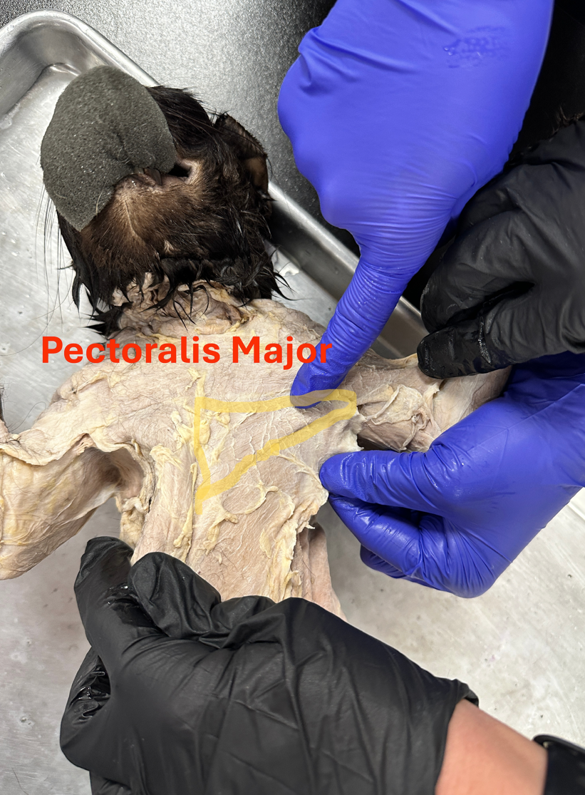 <p>Pectoralis Major&nbsp;(Anterior shoulder and chest)</p>