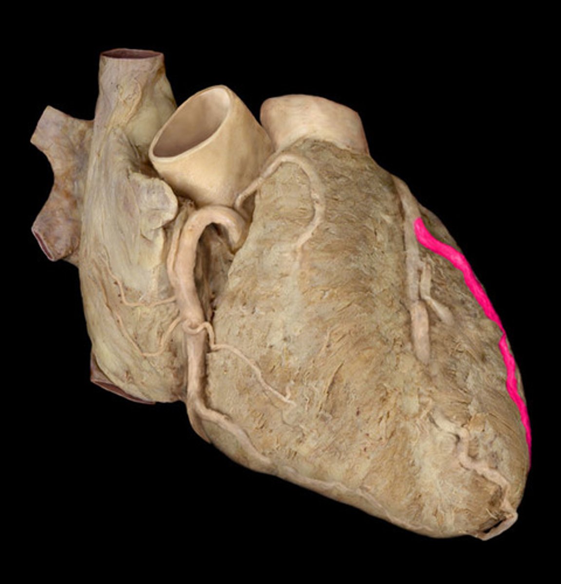 <p>left coronary artery branch</p>