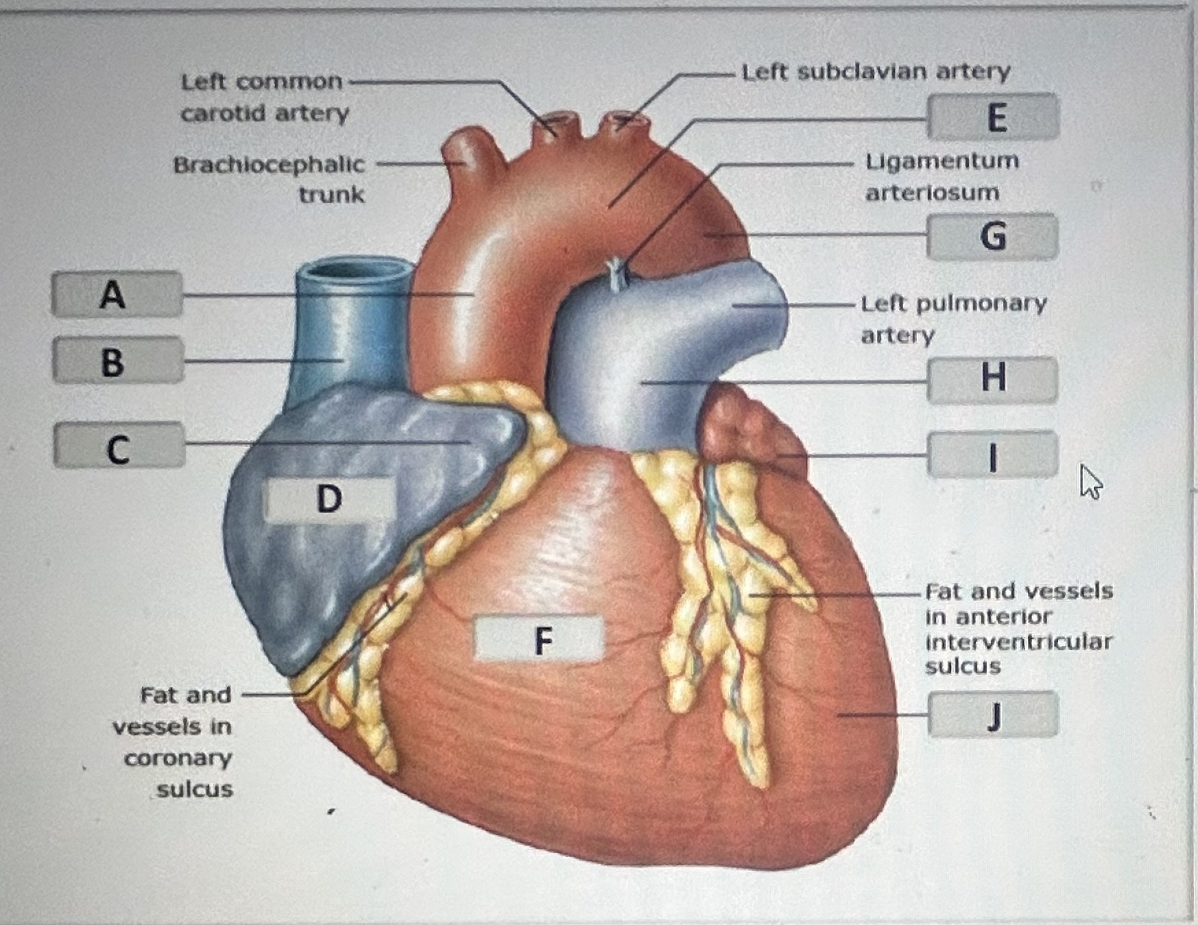 Identify the anatomical feature on the anterior surface of the heart labeled H 