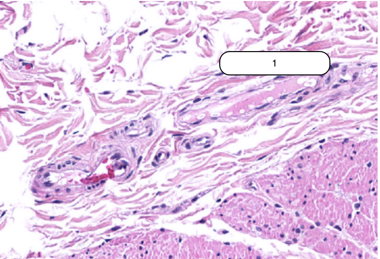 <p>Identify the structure labeled #1</p>