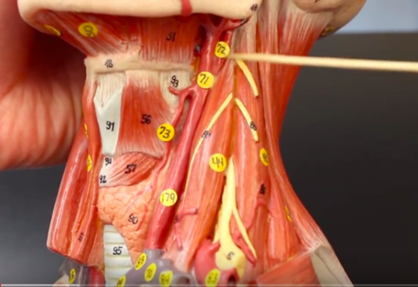 <p>Identify the vessel (#72; include artery vs vein)</p>
