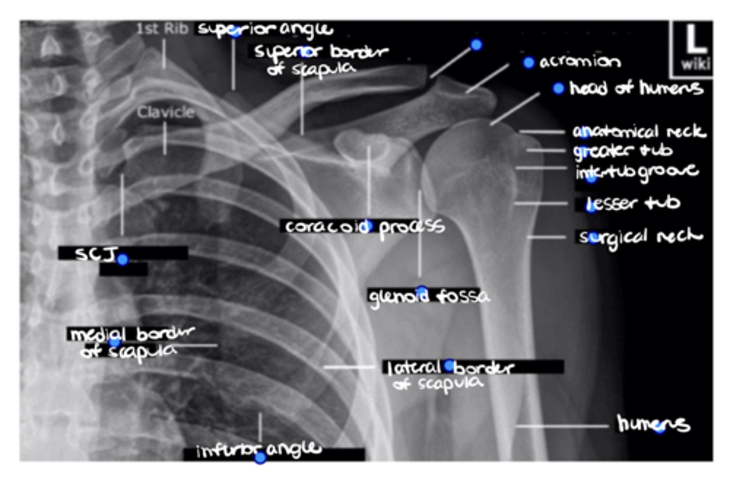 <p>ID the missing structure.</p>