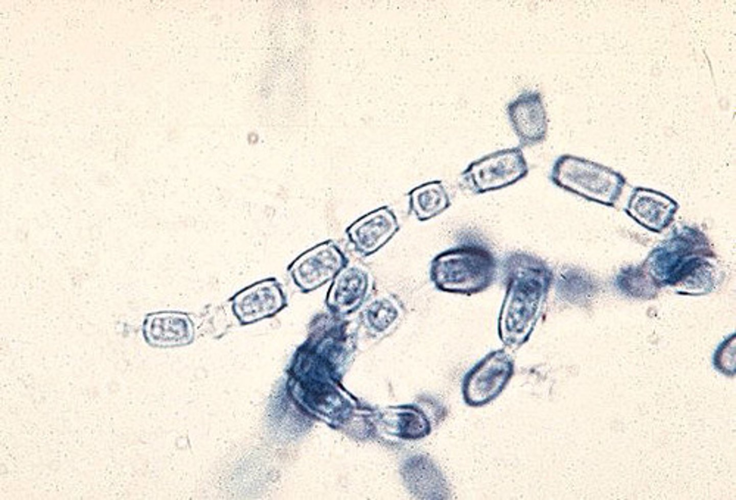 <p>Spherule form at 37 C</p><p>• Mold form</p><p>o Hyaline, septate with "Train</p><p>track" arthroconidia</p>
