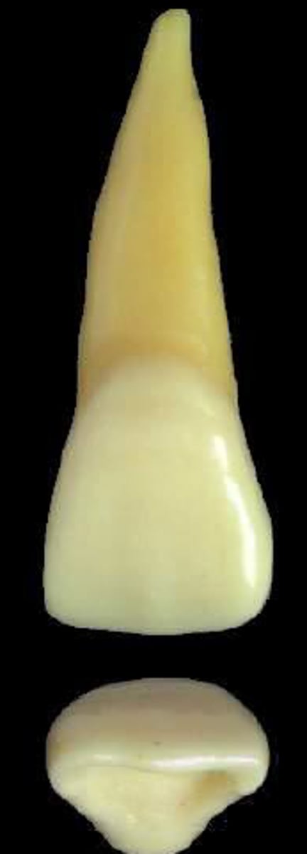 <p>what tooth is this &amp; why?</p>