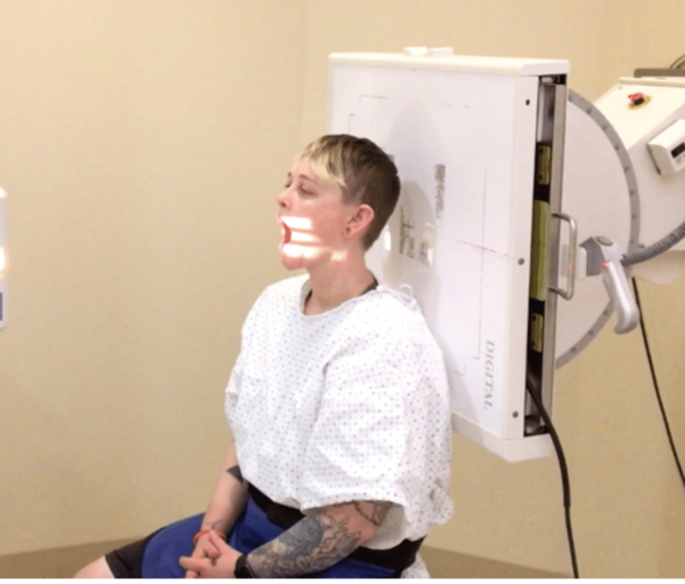 <p>Pt Placement: seated</p><p>Measure: corner of mouth to base of skull</p><p>Collimation: 8x10, below orbits into mastoids</p><p>CR Placement: middle of mouth</p><p>Tube tilt: none</p><p>SID: 40"</p><p>Breathing: DBDM</p>
