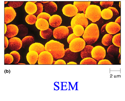 <p><span style="font-family: &quot;Times New Roman&quot;;">allows viewing of three-dimensional view of surfaces</span></p><p><span style="font-family: &quot;Times New Roman&quot;;">only can see outside surface (cell membrance, cilla, microvilli) </span></p><p></p>