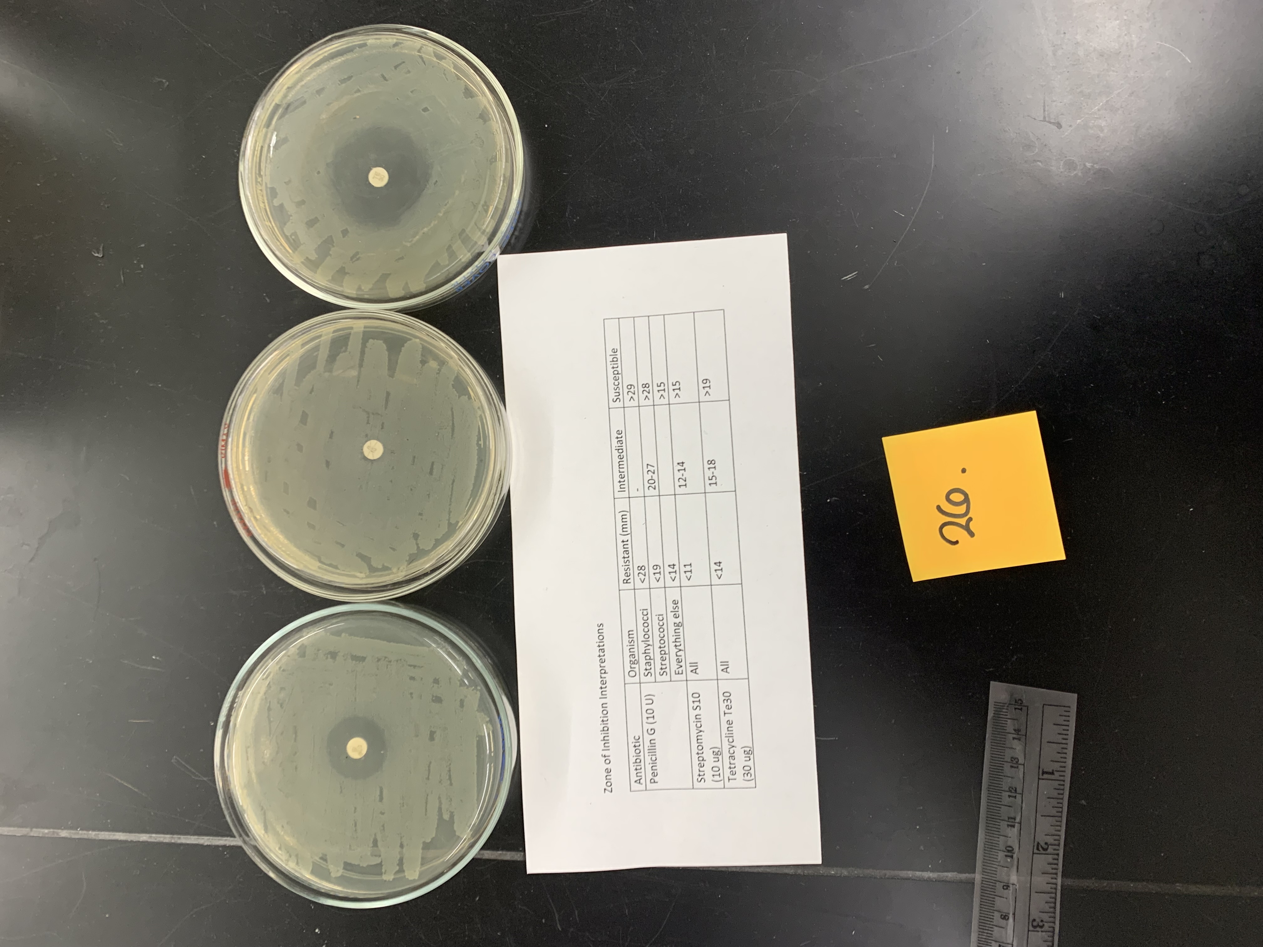 <p>if this is staphylococcus epidermis how would the results be interpreted; Penicillin G (10 U)</p>