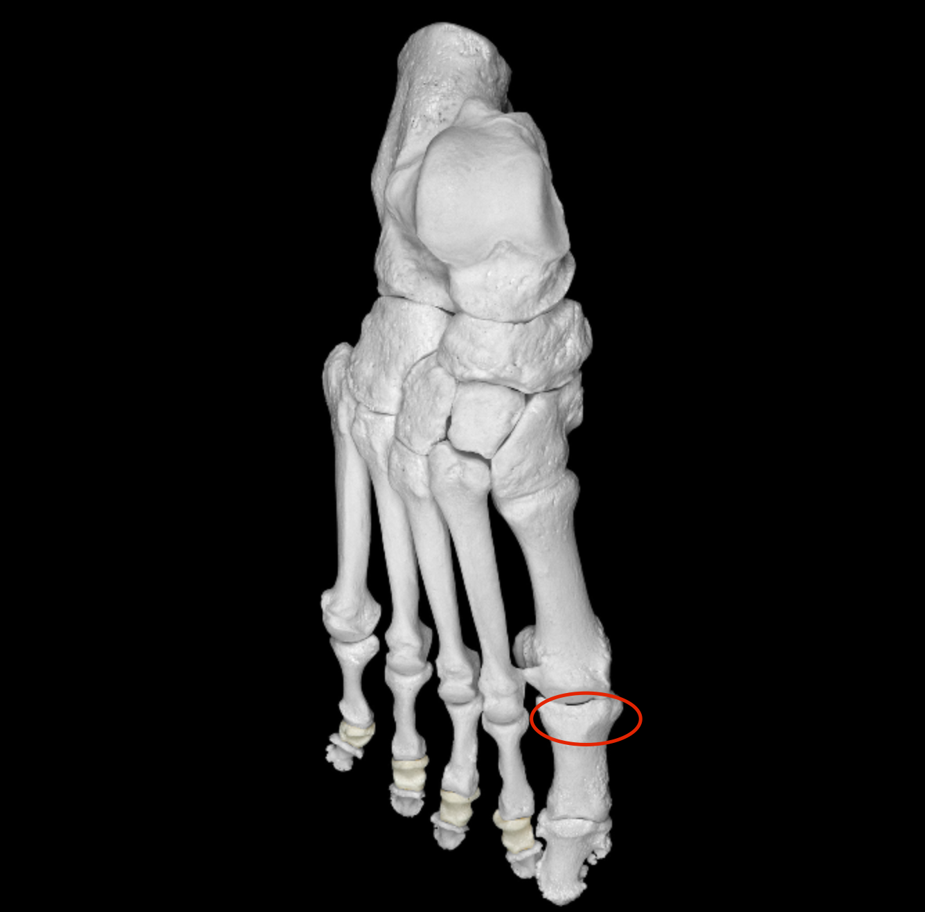 <p>proximal end of phalanx </p>