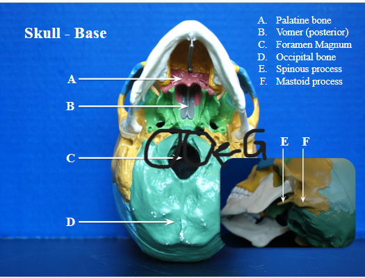 <p>Big bump behind styloid process, not pointy, blunt (temporal bone landmark) (F on image)</p>