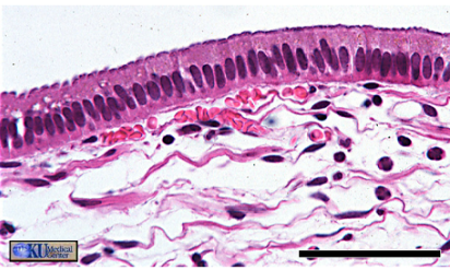 <p>Description: Single layer of tall, column-like cells with oval nuclei </p><p>Function: Protection, secretion of mucus, absorption </p><p>Location: Lining of stomach, intestine, gallbladder, uterine tube, collecting ducts of kidneys</p>