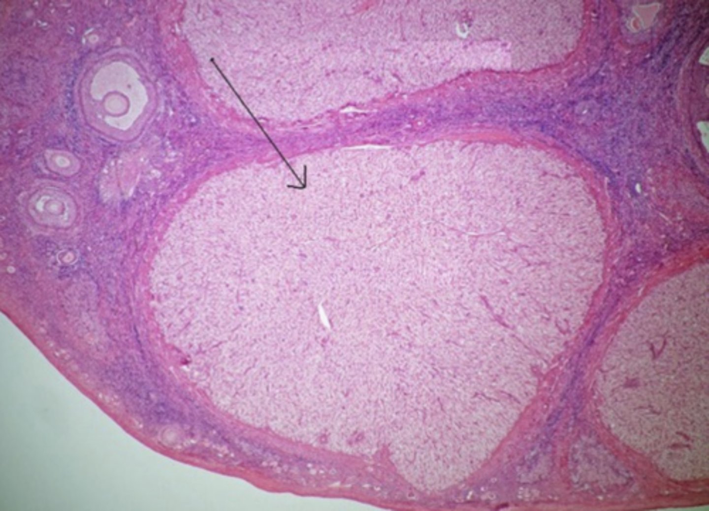 <p>What is the black arrow</p>