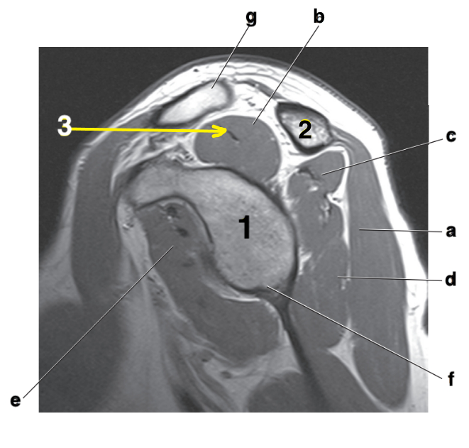 <p>What is letter b?</p>