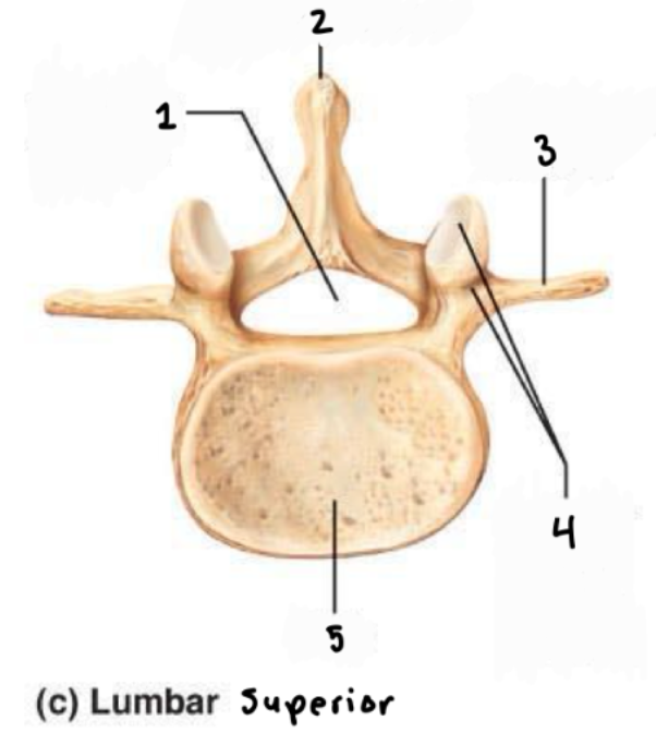 <p>What is #2 in the superior view of a Lumbar vertebrae?</p>