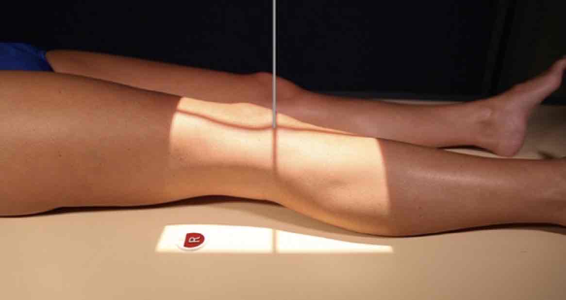 <p>What Projection is this?</p>