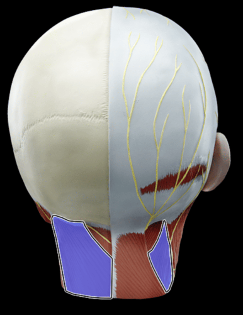 <p>What Muscle Is Highlighted?</p>