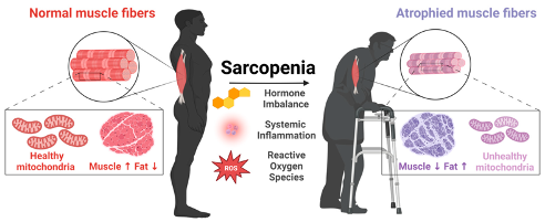 <p>•<span>Age-related loss of skeletal muscle &amp; muscle strength</span></p><p>•<span>Thought to be secondary to progressive muscular changes and decreased anabolic hormones, more fat, risk of falls</span></p><p></p>