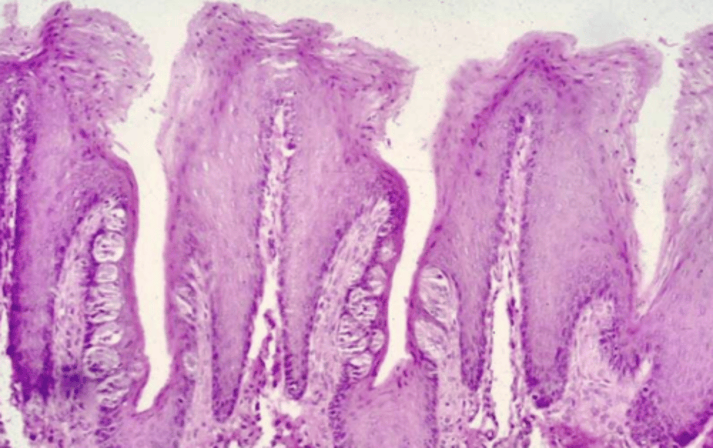 <p>what type of lingual papillae? why?</p>
