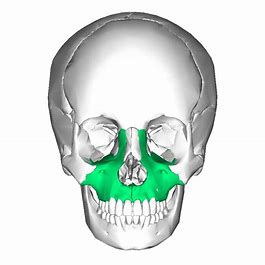 <p>What facial bone is this? </p>